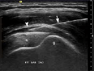 ultrasound Injections